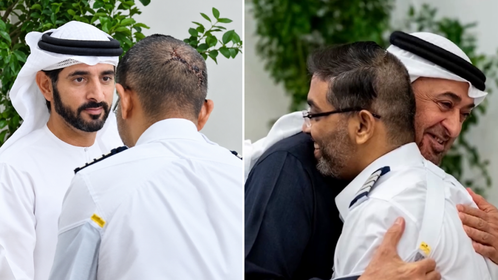 Flydubai hero pilot Smit Machchhar’s head stitches, bandaged hand revealed